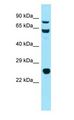 HSP90AB1 / HSP90 Alpha B1 Antibody - HSP90AB1 / HSP90 antibody Western Blot of Mouse Thymus.  This image was taken for the unconjugated form of this product. Other forms have not been tested.