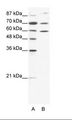 HSP90AB1 / HSP90 Alpha B1 Antibody - A: Marker, B: HepG2 Cell Lysate.  This image was taken for the unconjugated form of this product. Other forms have not been tested.