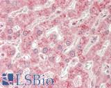 HSPA13 Antibody - Human Liver: Formalin-Fixed, Paraffin-Embedded (FFPE).  This image was taken for the unconjugated form of this product. Other forms have not been tested.