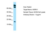 HSPB11 Antibody -  This image was taken for the unconjugated form of this product. Other forms have not been tested.