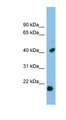 HSPB2 / HSP27 Antibody - HSPB2 antibody Western blot of ACHN lysate. This image was taken for the unconjugated form of this product. Other forms have not been tested.