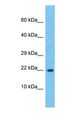 HSPB2 / HSP27 Antibody - Western blot of HSPB2 Antibody with human HeLa Whole Cell lysate.  This image was taken for the unconjugated form of this product. Other forms have not been tested.
