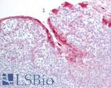 HSPB8 / H11 / HSP22 Antibody - Human Tonsil: Formalin-Fixed, Paraffin-Embedded (FFPE)