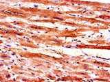HSPC167 / CDK5RAP1 Antibody - Immunohistochemistry of paraffin-embedded human heart tissue using MAL Antibody at dilution of 1:100