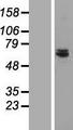 HSPC167 / CDK5RAP1 Protein - Western validation with an anti-DDK antibody * L: Control HEK293 lysate R: Over-expression lysate