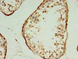 HSPC176 / TRAPPC2L Antibody - Immunohistochemistry of paraffin-embedded human testis tissue using antibody at dilution of 1:100.
