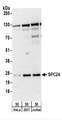 HSpc24 / SPBC24 Antibody - Detection of Human SPC24 by Western Blot. Samples: Whole cell lysate (50 ug) from HeLa, 293T, and Jurkat cells. Antibodies: Affinity purified rabbit anti-SPC24 antibody used for WB at 0.1 ug/ml. Detection: Chemiluminescence with an exposure time of 3 minutes.