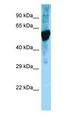 HSPD1 / HSP60 Antibody - HSPD1 / HSP60 antibody Western Blot of Rat Muscle.  This image was taken for the unconjugated form of this product. Other forms have not been tested.