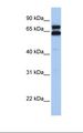 HSPD1 / HSP60 Antibody - Fetal liver lysate. Antibody concentration: 1.0 ug/ml. Gel concentration: 12%.  This image was taken for the unconjugated form of this product. Other forms have not been tested.