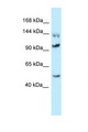 HSPH1 / HSP105 Antibody - HSPH1 / HSP105 antibody Western blot of Rat Brain lysate. Antibody concentration 1 ug/ml.  This image was taken for the unconjugated form of this product. Other forms have not been tested.