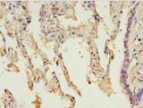 HsT19268 / MTHFS Antibody - Immunohistochemistry of paraffin-embedded human lung tissue using antibody at 1:100 dilution.  This image was taken for the unconjugated form of this product. Other forms have not been tested.