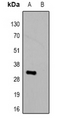 HSV Tag Antibody - Western blot analysis of Anti-HSV-tag Antibody against HEK293T cells transfected with vector overexpressing HSV tag (A) and untransfected (B).