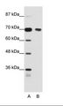 HT2A / TRIM32 Antibody - A: Marker, B: Jurkat Cell Lysate.  This image was taken for the unconjugated form of this product. Other forms have not been tested.