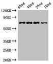 htpG Antibody - Western Blot Positive WB detected in Recombinant protein All Lanes:htpG antibody at 3µg/ml Secondary Goat polyclonal to rabbit IgG at 1/50000 dilution Predicted band size: 72 kDa Observed band size: 72 kDa