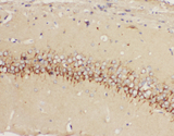 HTR1A / 5-HT1A Receptor Antibody - HTR1A / 5-HT1A Receptor antibody. IHC(P): Rat Brain Tissue.