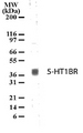 HTR1B / 5-HT1B Receptor Antibody - Western blot of 5-HT1BR in human brain lysate with anti-5-HT1BR pcAb. A protein band of approximate molecular weight of 40-41kD was detected.