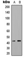 HTR1F / 5-HT1F Receptor Antibody - Western blot analysis of 5-HT1F expression in HEK293T (A); NIH3T3 (B) whole cell lysates.