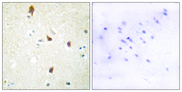 HTR2B / 5-HT2B Receptor Antibody - Immunohistochemistry analysis of paraffin-embedded human brain tissue, using 5-HT-2B Antibody. The picture on the right is blocked with the synthesized peptide.