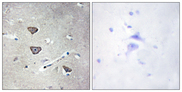 HTR2C / 5-HT2C Receptor Antibody - Immunohistochemistry analysis of paraffin-embedded human brain tissue, using 5-HT-2C Antibody. The picture on the right is blocked with the synthesized peptide.