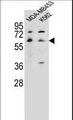 HTR3A / 5-HT3A Receptor Antibody - HTR3A Antibody western blot of MDA-MB453,K562 cell line lysates (35 ug/lane). The HTR3A antibody detected the HTR3A protein (arrow).