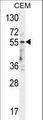 HTR3E / 5-HT3E Receptor Antibody - 5HT3E Antibody western blot of CEM cell line lysates (35 ug/lane). The 5HT3E antibody detected the 5HT3E protein (arrow).