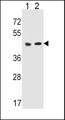HTR4 / 5-HT4 Receptor Antibody - HTR4 Antibody western blot of MDA-MB453(lane 1) cell line and mouse liver(lane 2) tissue lysates (35 ug/lane). The HTR4 antibody detected the HTR4 protein (arrow).