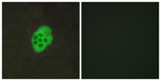 HTR4 / 5-HT4 Receptor Antibody - Immunofluorescence analysis of MCF7 cells, using HTR4 Antibody. The picture on the right is blocked with the synthesized peptide.