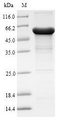 AADAC Protein - (Tris-Glycine gel) Discontinuous SDS-PAGE (reduced) with 5% enrichment gel and 15% separation gel.