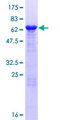 AAGAB Protein - 12.5% SDS-PAGE of human FLJ11506 stained with Coomassie Blue