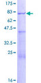 AAMP Protein - 12.5% SDS-PAGE of human AAMP stained with Coomassie Blue