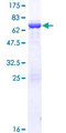 AAR2 Protein - 12.5% SDS-PAGE of human C20orf4 stained with Coomassie Blue