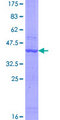 AASDH / ACSF4 Protein - 12.5% SDS-PAGE of human AASDH stained with Coomassie Blue