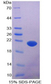 AATK / AATYK Protein - Recombinant Apoptosis Associated Tyrosine Kinase By SDS-PAGE