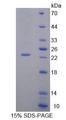 ABCA9 Protein - Recombinant ATP Binding Cassette Transporter A9 (ABCA9) by SDS-PAGE