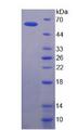 ABCB1 / MDR1 / P Glycoprotein Protein - Recombinant Permeability Glycoprotein By SDS-PAGE