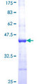 ABCF1 Protein - 12.5% SDS-PAGE Stained with Coomassie Blue.