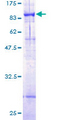ABCG4 Protein - 12.5% SDS-PAGE of human ABCG4 stained with Coomassie Blue
