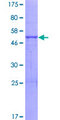 ABHD14A Protein - 12.5% SDS-PAGE of human ABHD14A stained with Coomassie Blue