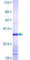 ABR Protein - 12.5% SDS-PAGE Stained with Coomassie Blue.