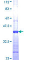 ACAD8 Protein - 12.5% SDS-PAGE Stained with Coomassie Blue.