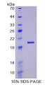 ACAN / Aggrecan Protein - Recombinant Aggrecan By SDS-PAGE