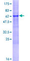 ACBD4 Protein - 12.5% SDS-PAGE of human ACBD4 stained with Coomassie Blue