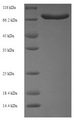 ACBD5 Protein - (Tris-Glycine gel) Discontinuous SDS-PAGE (reduced) with 5% enrichment gel and 15% separation gel.