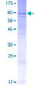 ACCN5 / HINAC Protein - 12.5% SDS-PAGE of human ACCN5 stained with Coomassie Blue