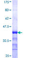 ACCS / ACS Protein - 12.5% SDS-PAGE Stained with Coomassie Blue.