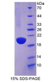 ACE / CD143 Protein - Recombinant Angiotensin I Converting Enzyme By SDS-PAGE