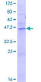 ACER2 Protein - 12.5% SDS-PAGE of human ASAH3L stained with Coomassie Blue