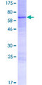 ACPT Protein - 12.5% SDS-PAGE of human ACPT stained with Coomassie Blue