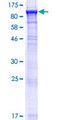 ACSBG1 / hsBG Protein - 12.5% SDS-PAGE of human ACSBG1 stained with Coomassie Blue