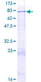 ACSF3 Protein - 12.5% SDS-PAGE of human ACSF3 stained with Coomassie Blue